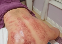 Gua Sha 4